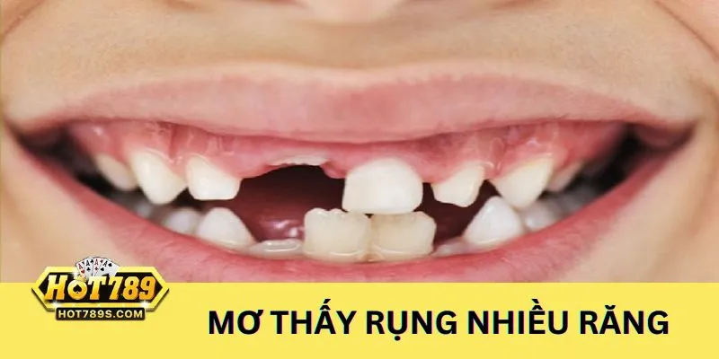 Nằm mơ thấy rụng răng nhiều răng nên chơi lô đề các số 15 hoặc 67